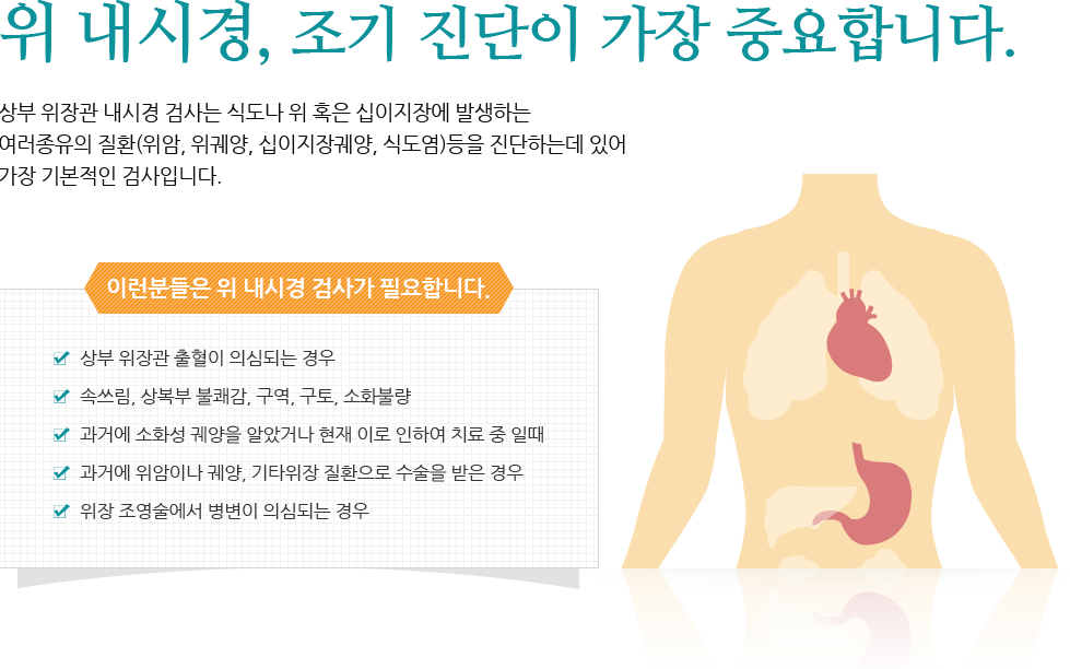 위 내시경, 조기 진단이 가장 중요합니다.