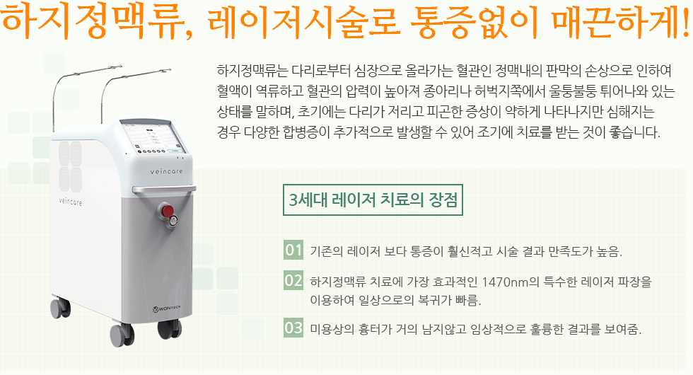 하지정맥류, 레이저시술로 통증없이 매끈하게!