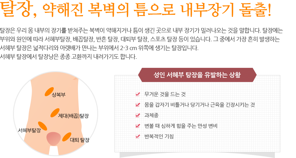 탈장, 약해진 복벽의 틈으로 내부장기 돌출!