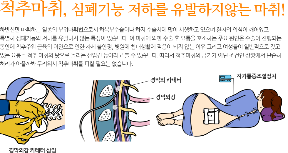 척추마취, 심폐기능 저하를 유발하지않는 마취!