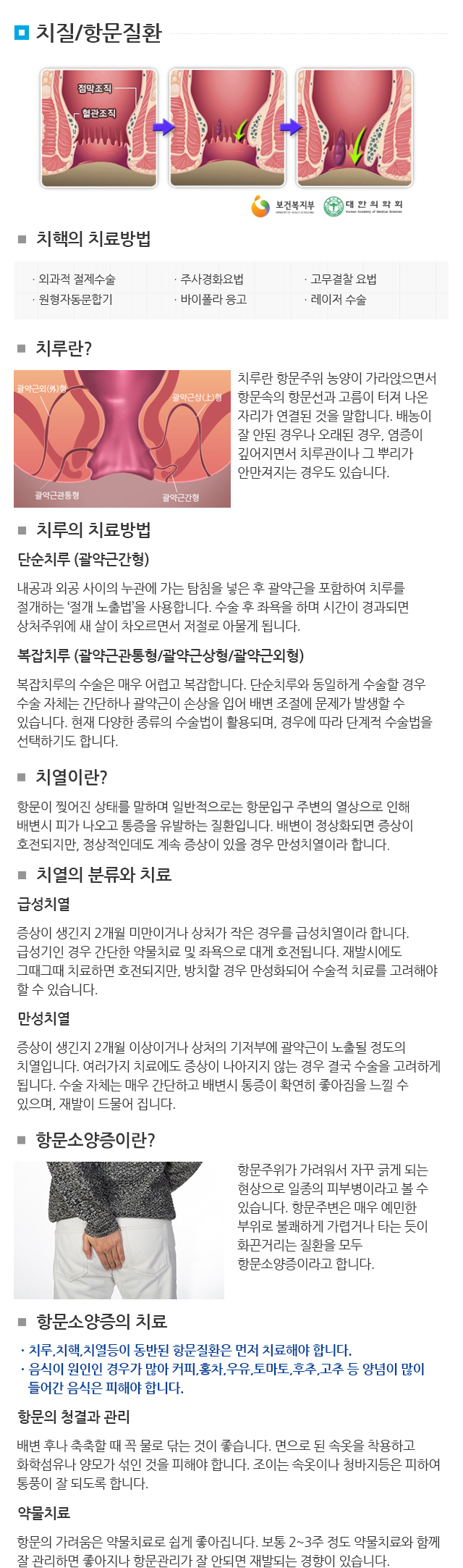 치질/항문질환